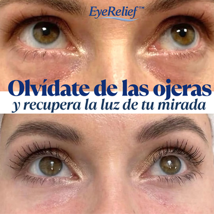 Alivio para bolsas, ojeras y ojos cansados - EyeRelief™