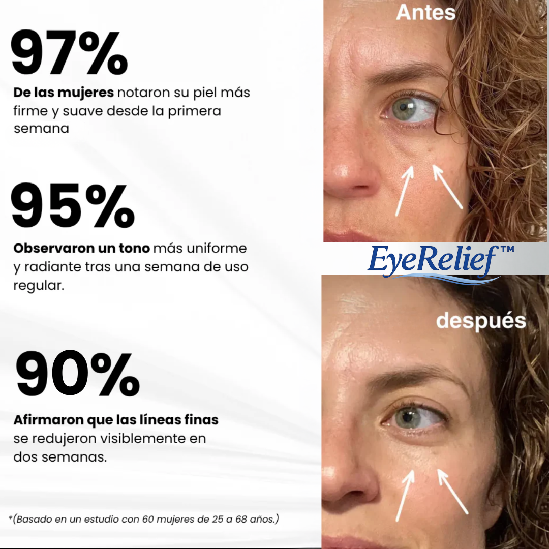 Alivio para bolsas, ojeras y ojos cansados - EyeRelief™