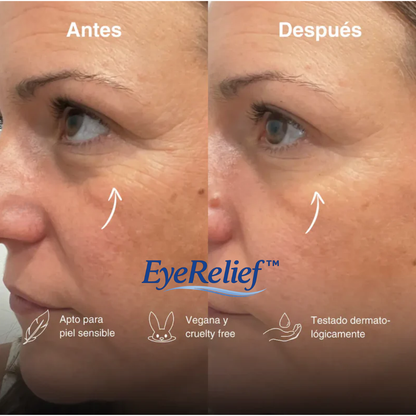 Alivio para bolsas, ojeras y ojos cansados - EyeRelief™